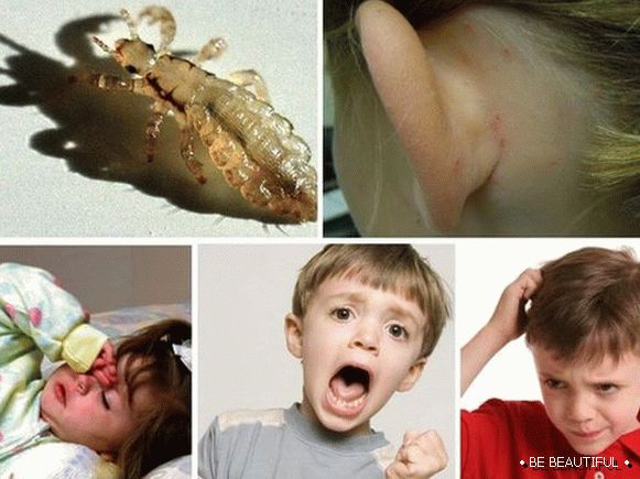 Какви са опасните въшки за деца