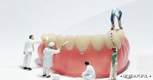 възстановяване на зъбите