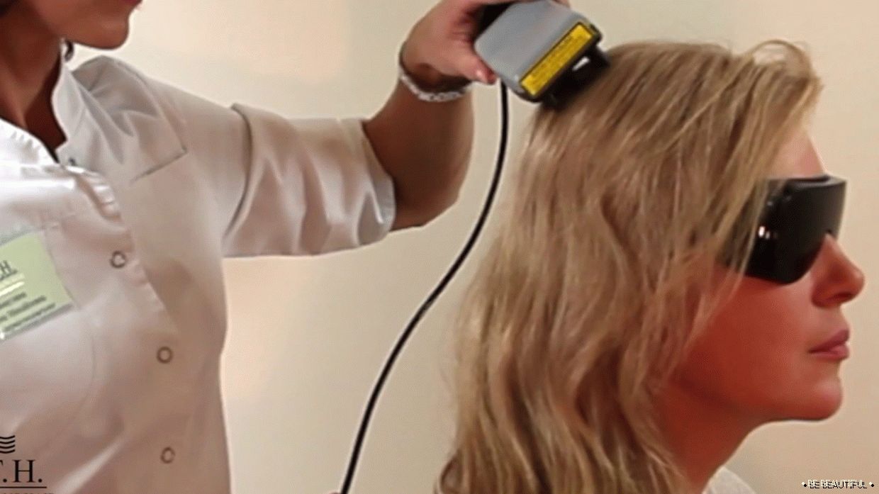 Лазерна терапия за коса