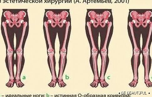 класификация на формата на краката