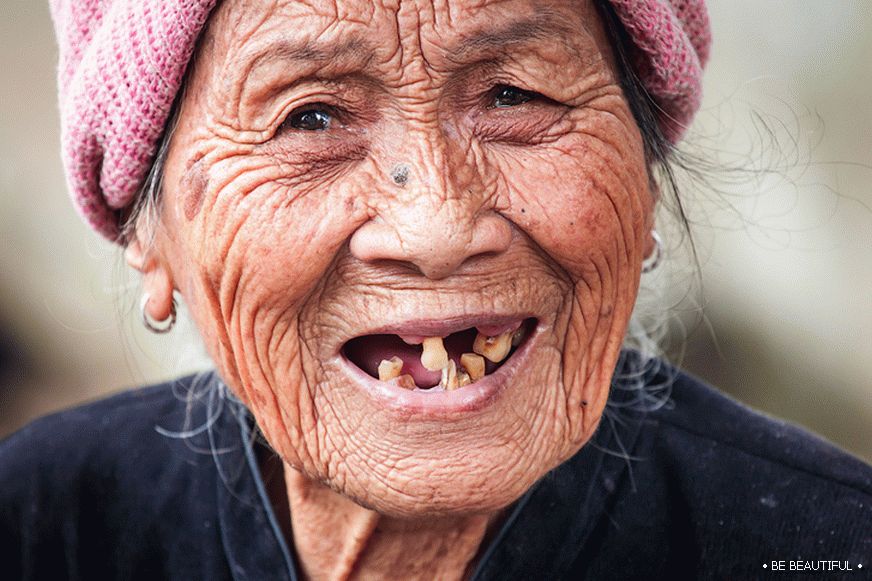 вашият ата усмивка: зъбните импланти - ефективни решение за загуба на зъби!